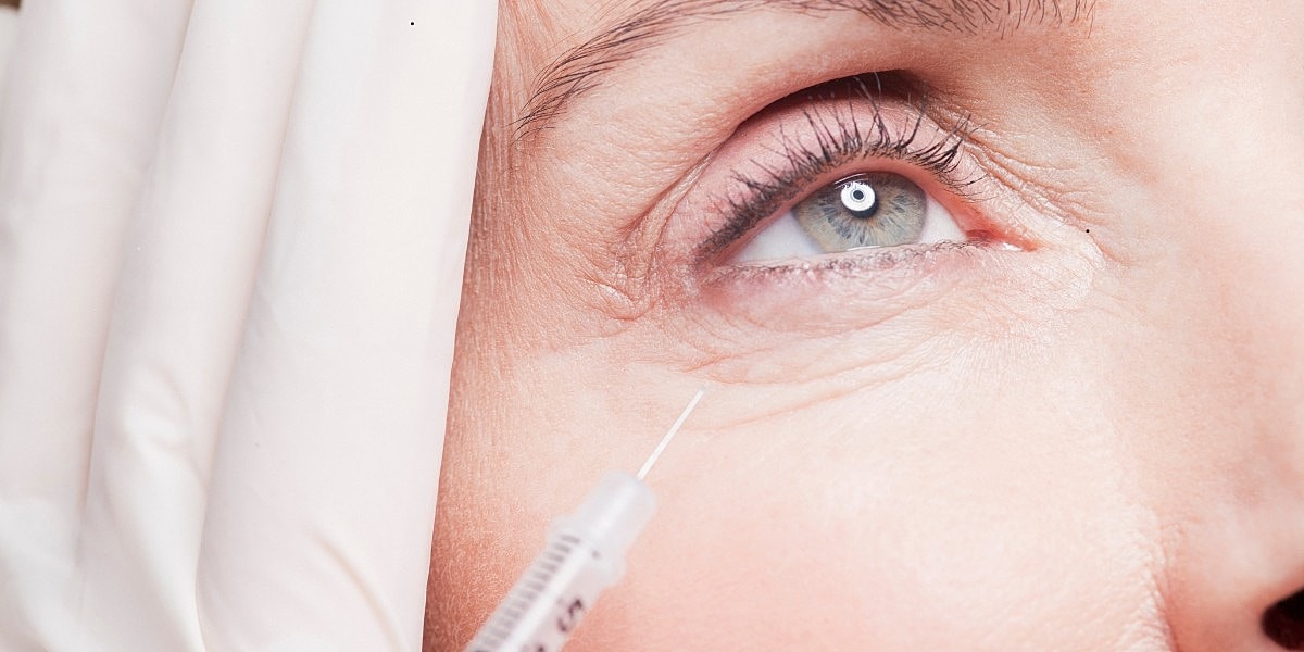 Under-Eye Filler for Hollows:What It Fixes and What It Can’t