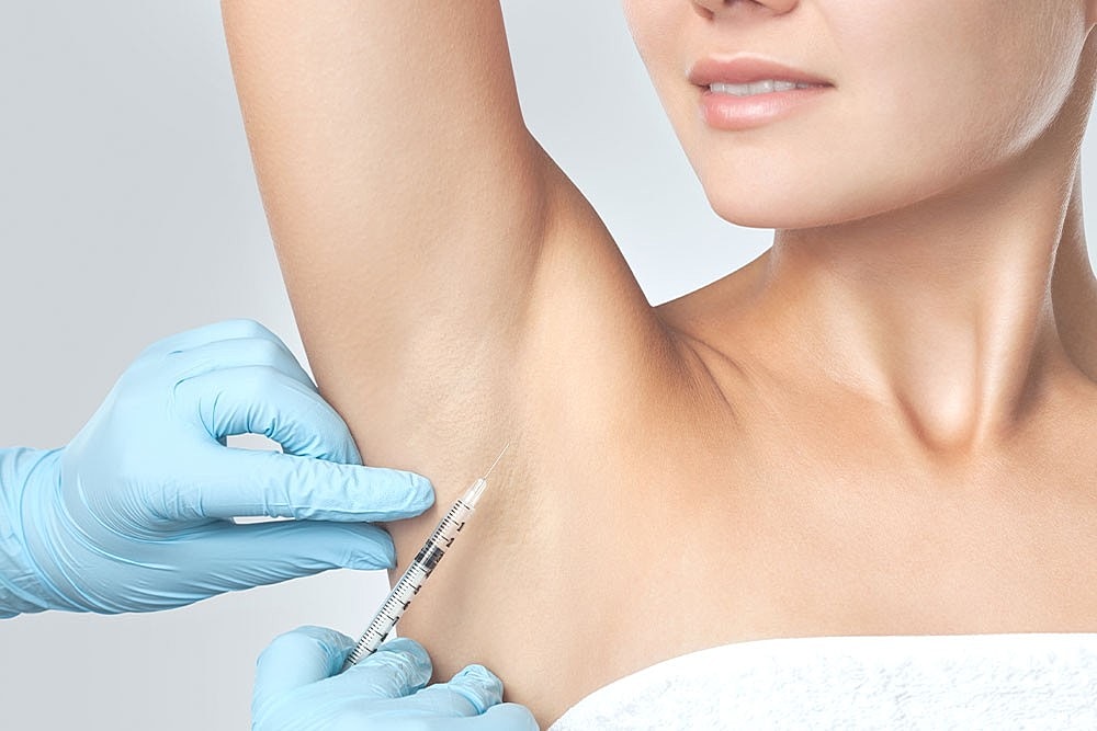 Understanding Botox for Hyperhidrosis: A Solution for Excessive Sweating