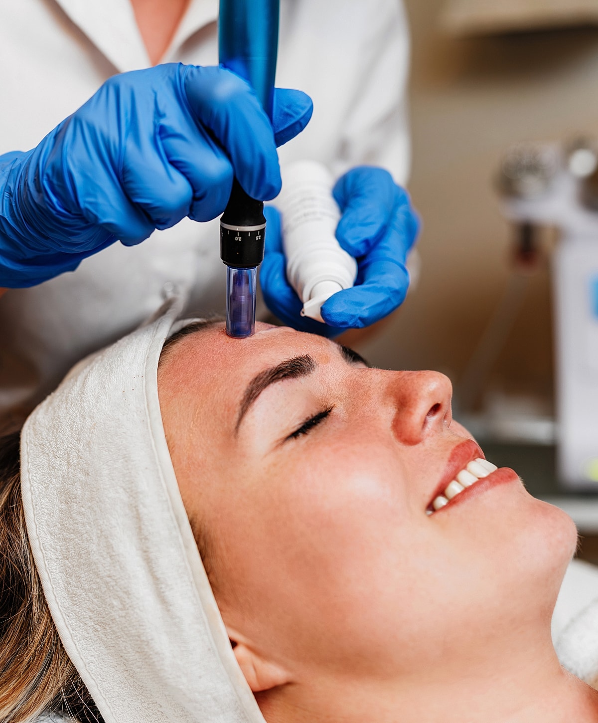 Microneedling treatment in a skincare session.