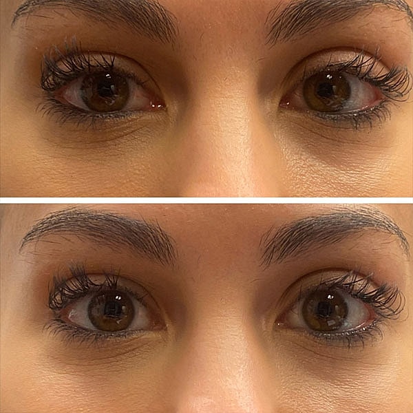 Upneeq Before & After