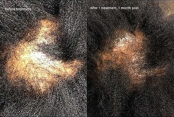 Hair Rejuvenation Before & After